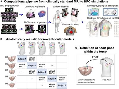 MRI-Based Computational Torso/Biventricular Multiscale Models to Investigate the Impact of Anatomical Variability on the ECG QRS Complex